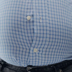 obezite tedavisinde psikolojik destek izmir